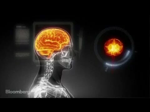 Building a Working Human Brain on a Supercomputer