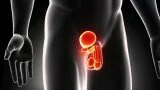 “MALE PELVIC FITNESS: Optimizing Sexual & Urinary Health” Coming Soon